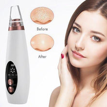 Load image into Gallery viewer, Blackhead Vacuum Cleaner