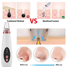 Load image into Gallery viewer, Blackhead Vacuum Cleaner