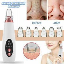 Load image into Gallery viewer, Blackhead Vacuum Cleaner